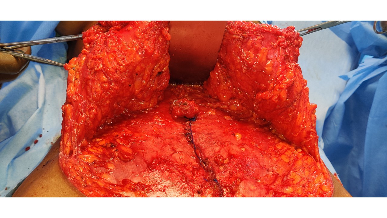 Suvarna Talk Photo 5